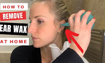 how to remove stubborn ear wax at home 2023
